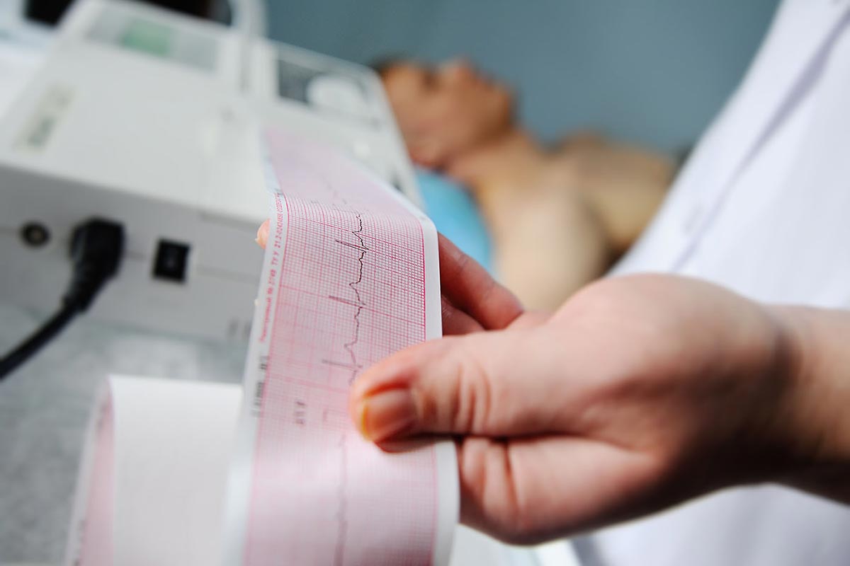 Cardiovascular Imaging services