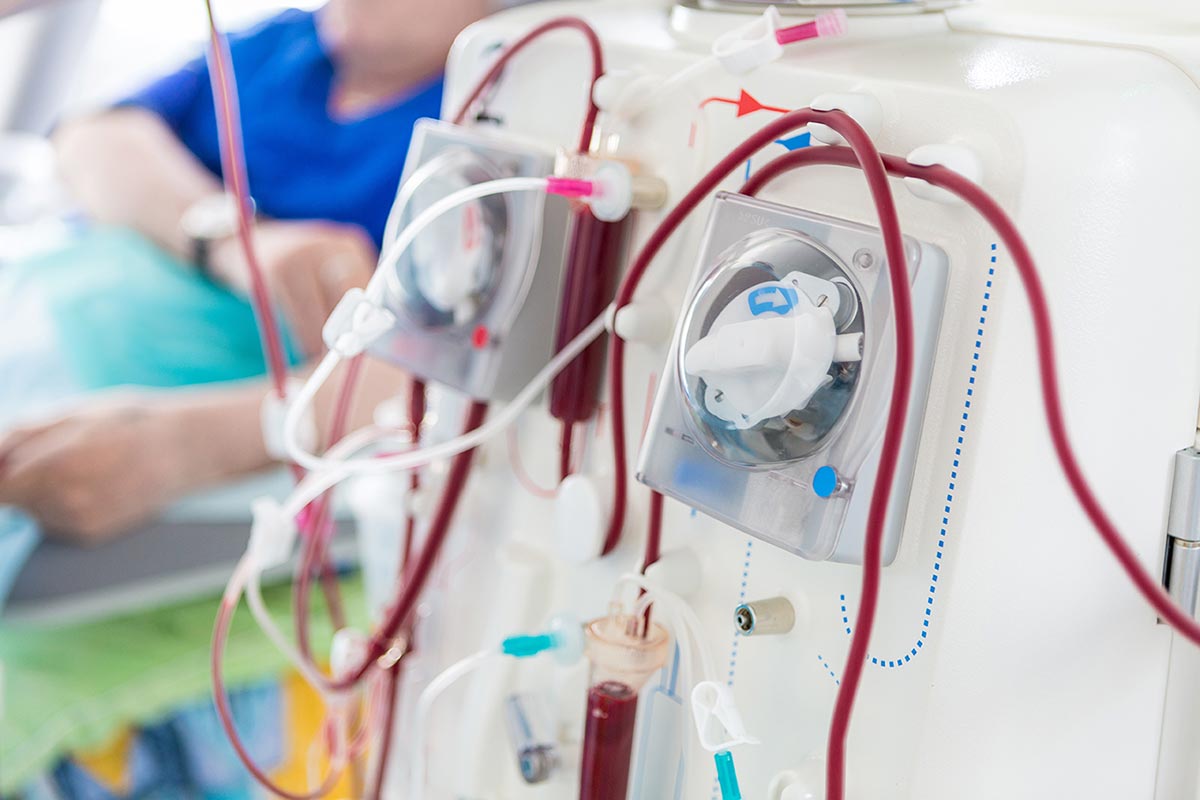 renal dialysis services