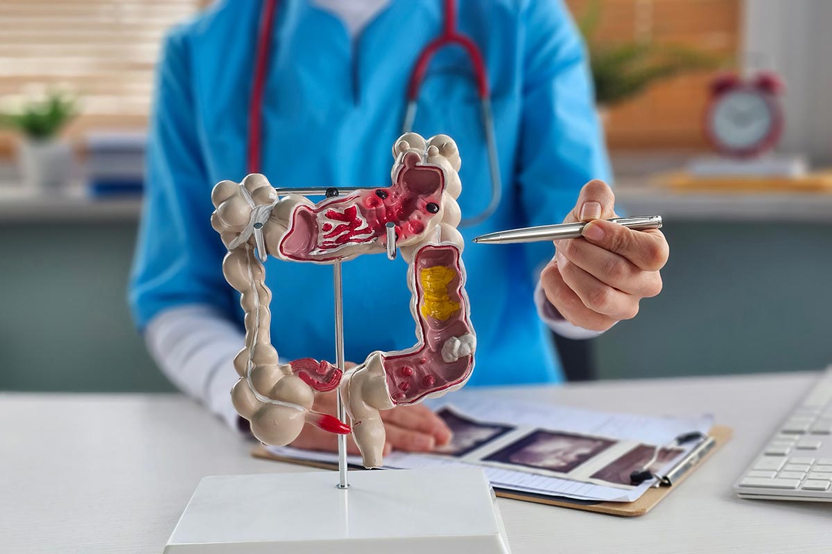 gastroenterology doctor explaining diagram